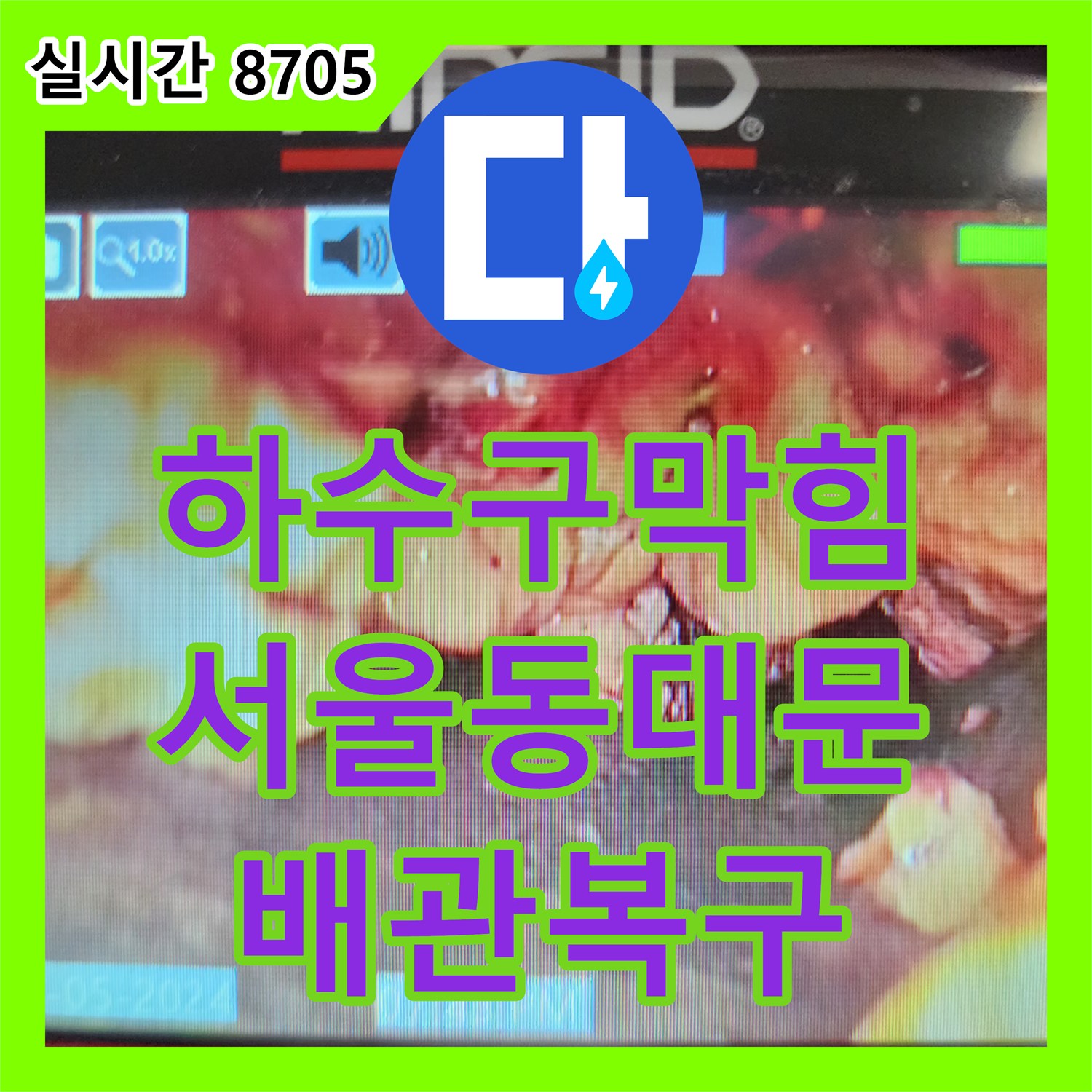 하수구막힘 심각한 슬러지로 가득했던 싱크대 배관을 내시경 진단 후 스케일링으로 해결한 서울 동대문구 답십리동 사례